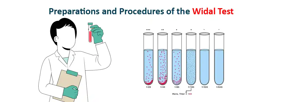 Preparations and Procedures of the Widal Test